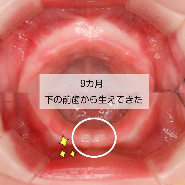 赤ちゃんの歯はいつ生える?