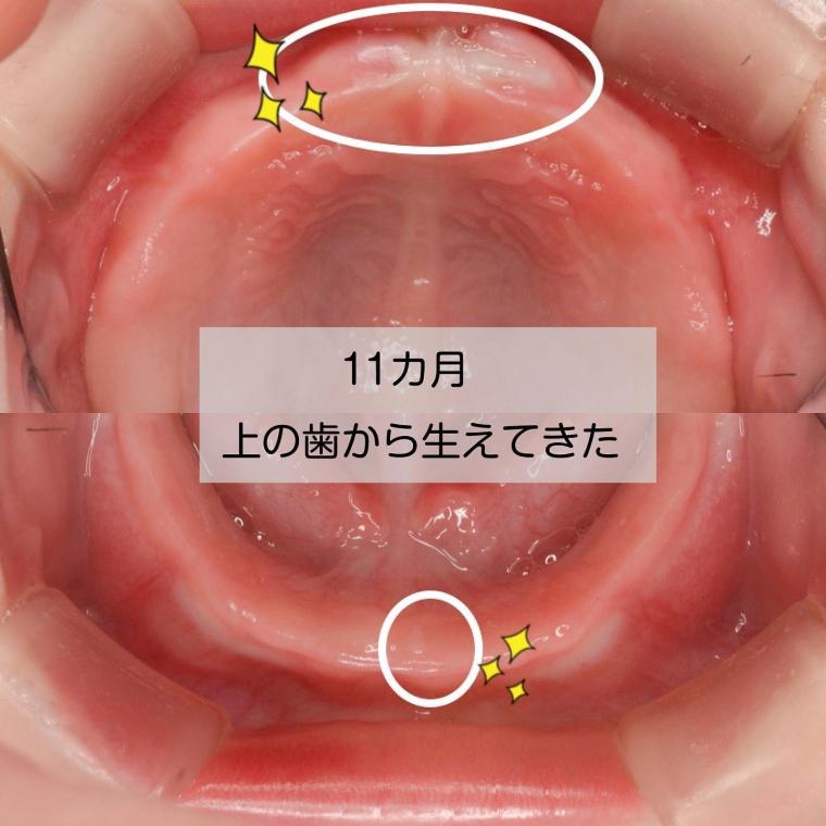 赤ちゃんの歯はいつ生える?