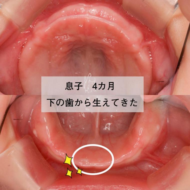 赤ちゃんの歯はいつ生える?